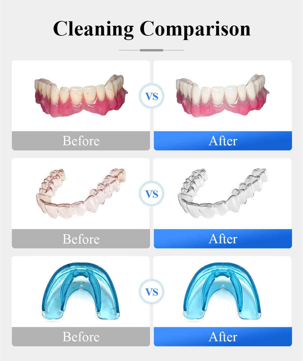 TULLKER Ultrasonic Retainer Cleaner For Dentures Braces With UV Light